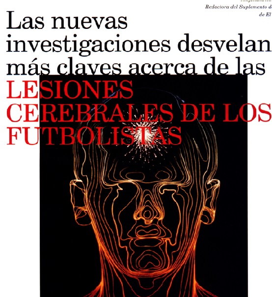 Lesiones cerebrales de los futbolistas